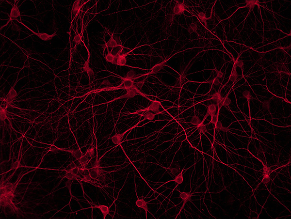 MV20-N 显微镜摄像头 摄像头