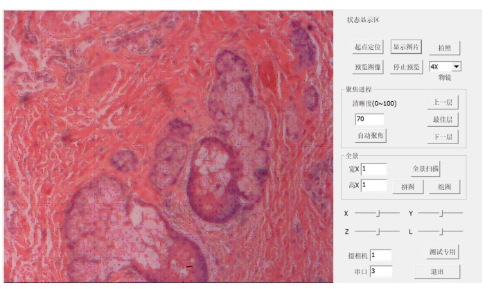 全自动聚焦显微镜 全自动聚焦显微镜